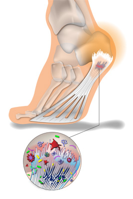 Plantar-3-attract-and-gow-new-cells-and-tissues